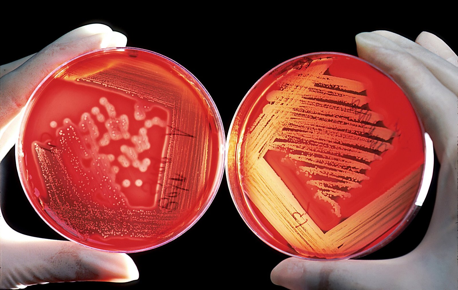 Patrones de Coinfección en Microsporidiosis de Camarones