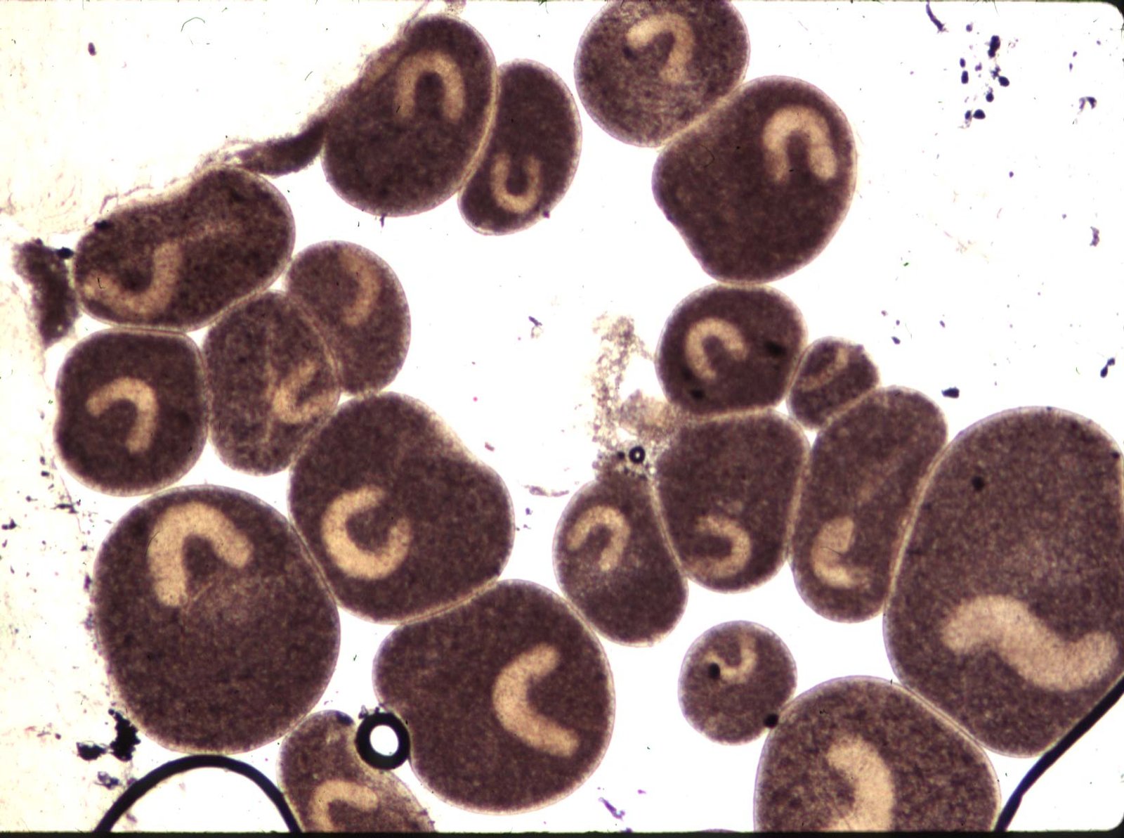 Pez de agua dulce mostrando las características manchas blancas de la infección por Ichthyophthirius multifiliis